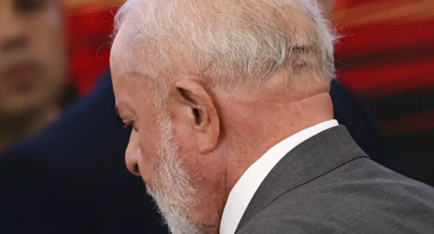 Médico de Lula descarta sequela e diz que função cerebral está intacta